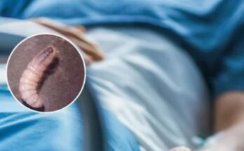 El paciente regresa a Linares después de una notable recuperación de una grave infección por gusano barrenador.
