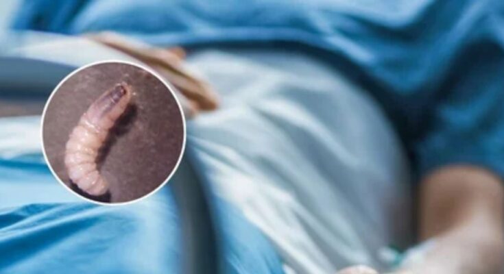 El paciente regresa a Linares después de una notable recuperación de una grave infección por gusano barrenador.