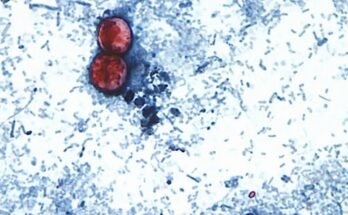 Alertas sobre el perejil y cilantro mexicano tras brote de Cyclospora en Estados Unidos. Detalles aquí.