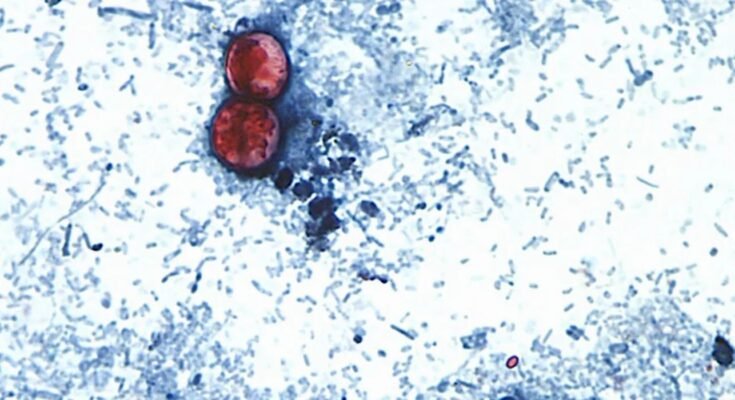 Alertas sobre el perejil y cilantro mexicano tras brote de Cyclospora en Estados Unidos. Detalles aquí.